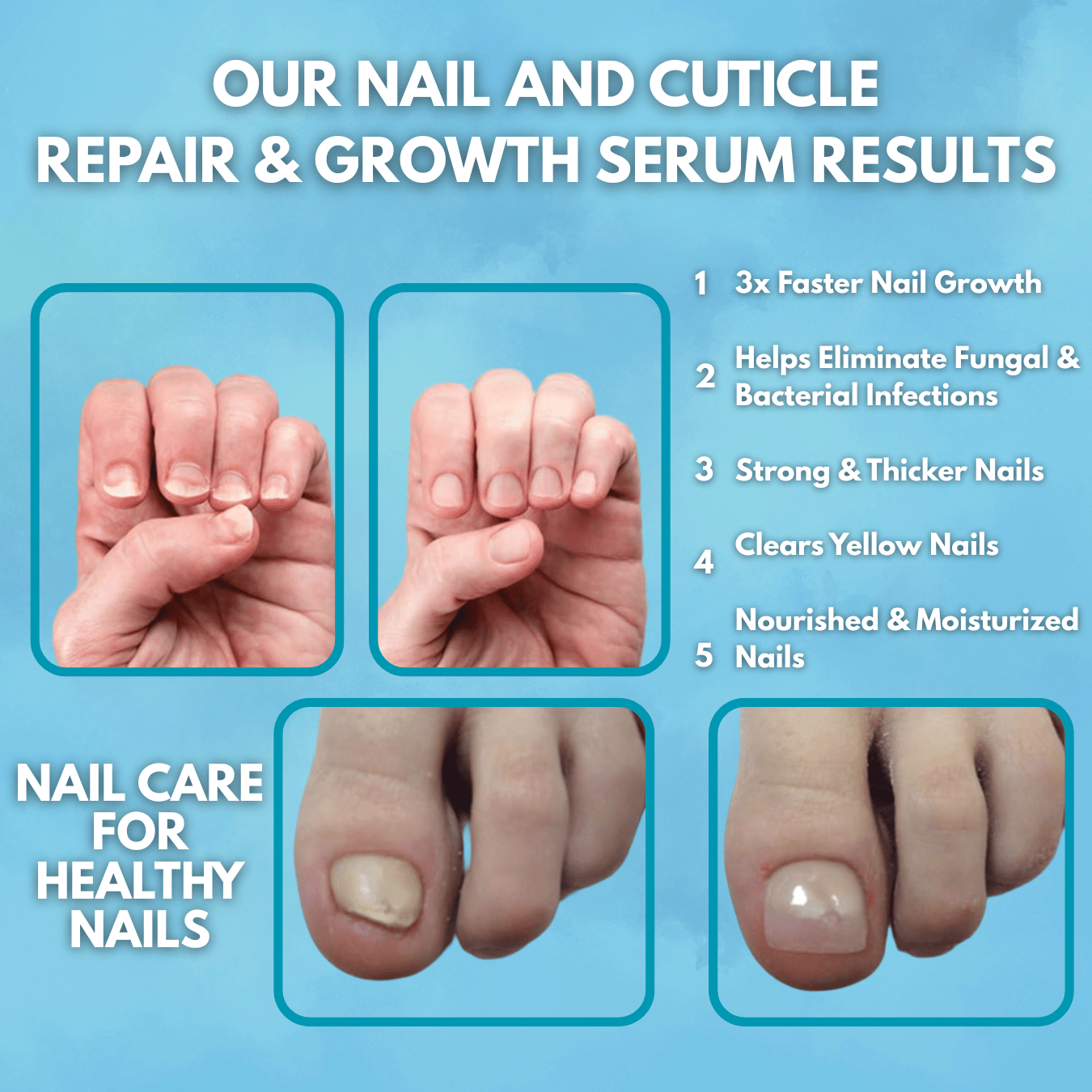 NailCare PRO Serum - For Complete Nail Protection and Fungus Free Nails