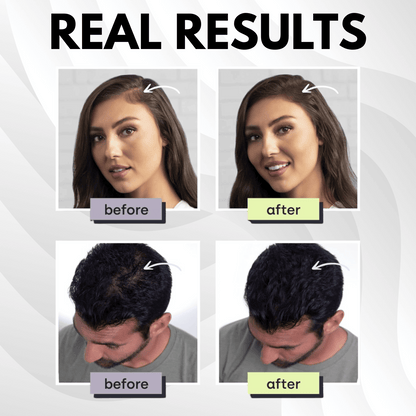 HairGrow - Hair Building Fibres For Men